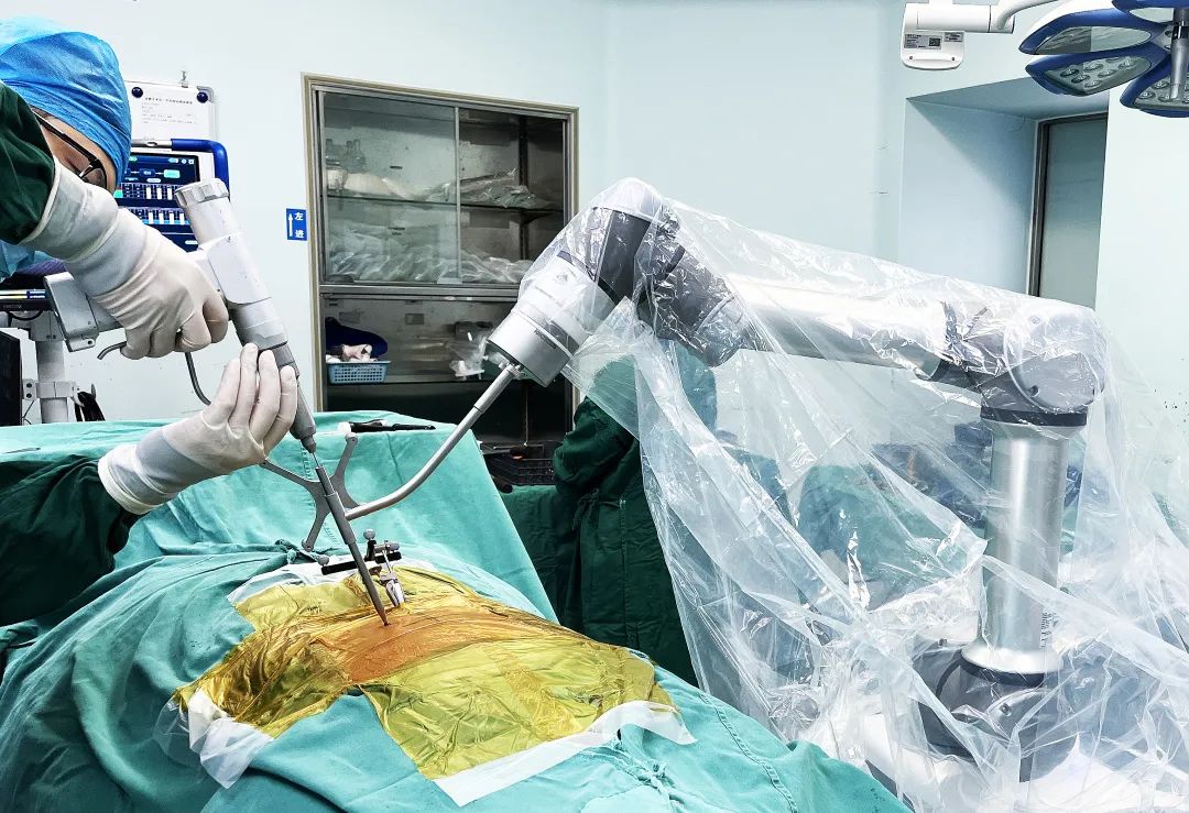 【Clinical Case】Perlove Medical Orthopedic Surgical Robot Assists in Complex Minimally Invasive Spinal Surgery!