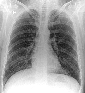 How Do X-rays Work?