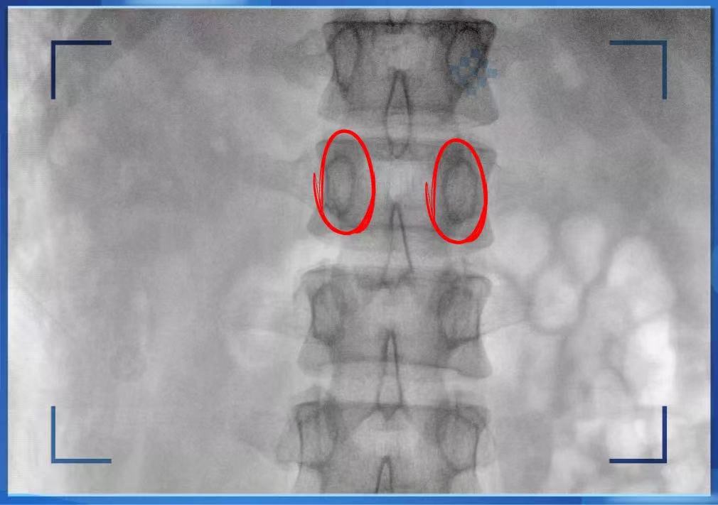 [How much do you know about the spine] Lecture 1: What can 3D imaging bring to the clinic?