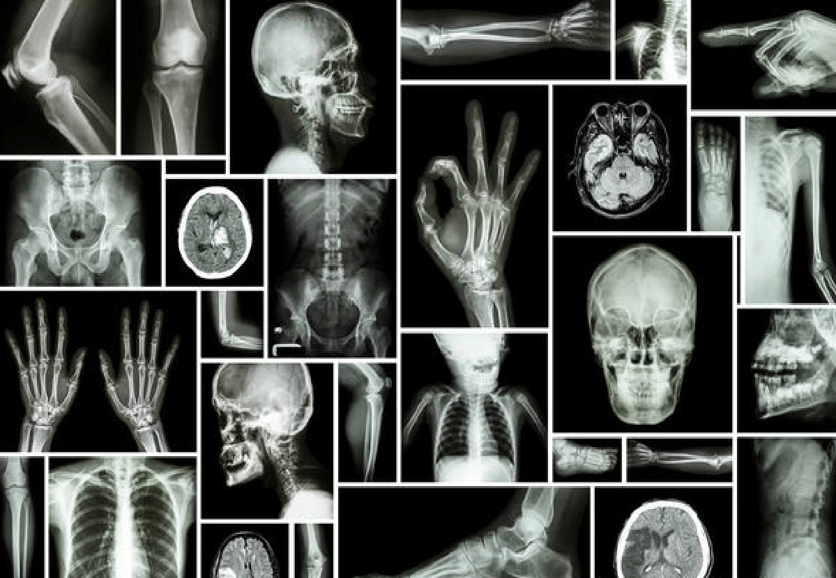 Differences between xray, CT scan and MRI