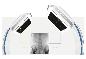 Bigger field of view Better - Solution for diaphyseal fractures