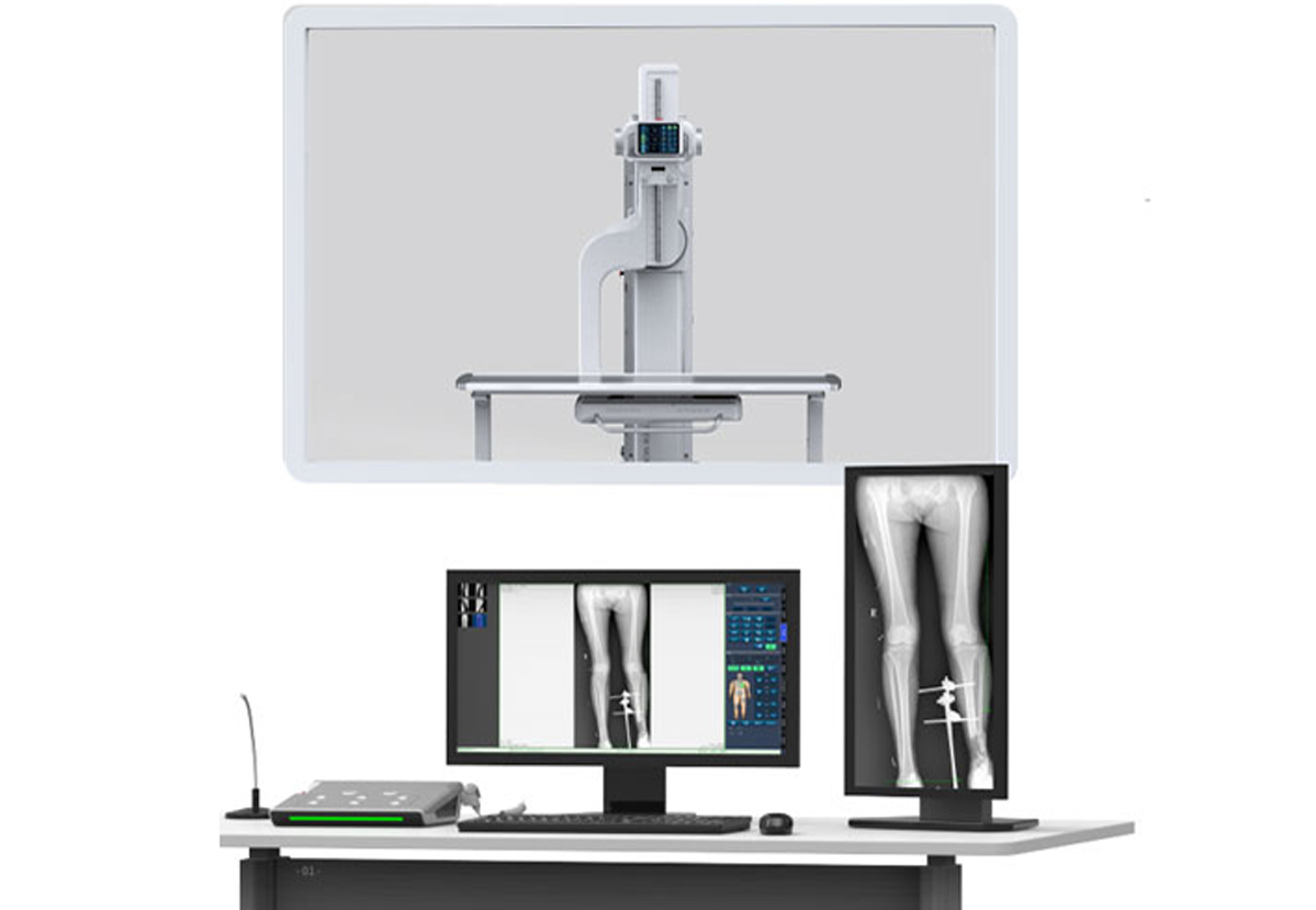 Breakthrough in Full-body radiography——PLX8600 dynamic digital X-ray radiography