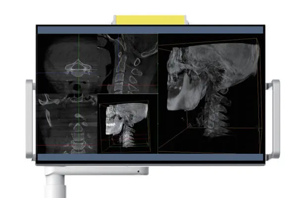 How many steps do you need to creat a 3D x-ray image?