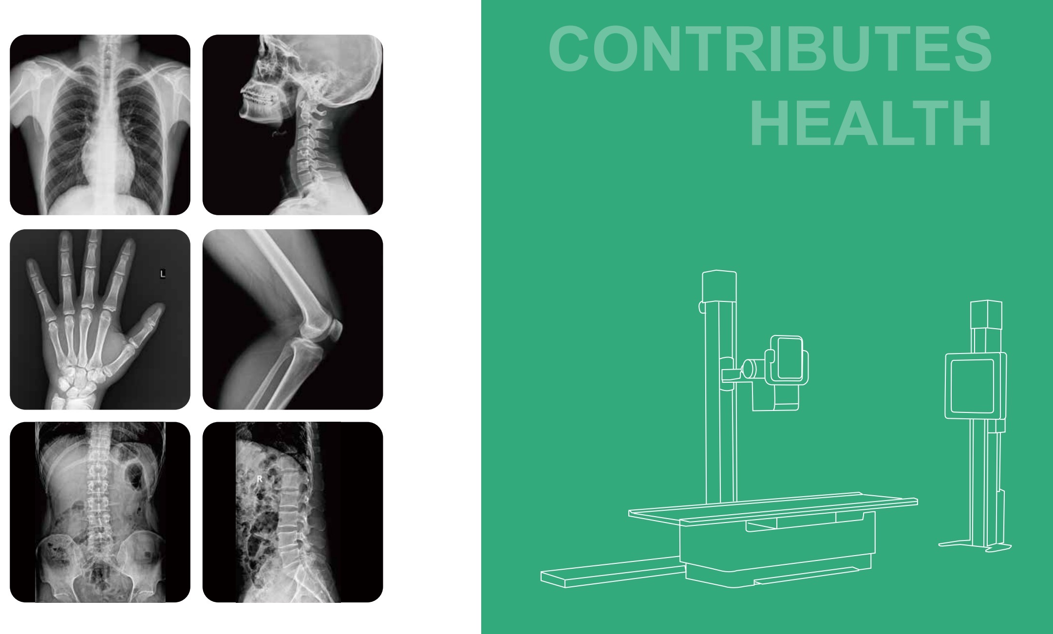 Rich options for clinical application-Perlove New Digital Radiography Floor Mounted Series