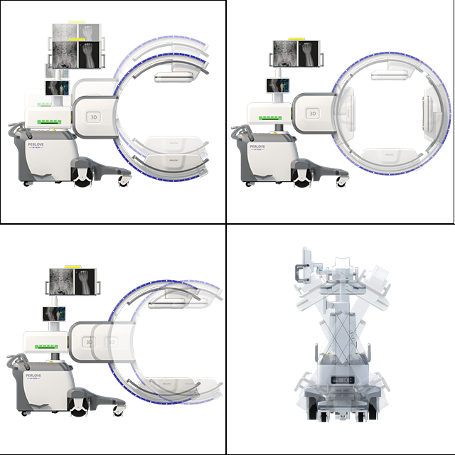 3D flat-panel C-arm imaging in pelvic fracture surgery 