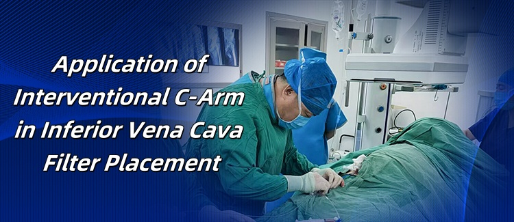  Application of Interventional C-Arm in Inferior Vena Cava Filter Placement