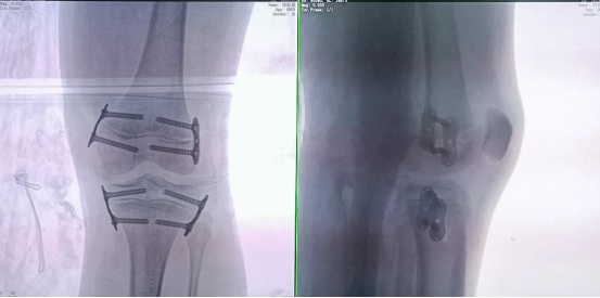 6788bd266b446fb9a1fe0002f6eadfc9.png 6788bd266b446fb9a1fe0002f6eadfc9.png