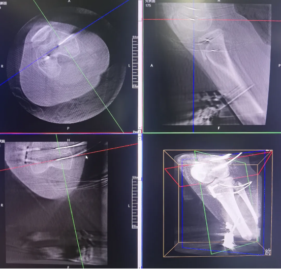 68d66fdd572810f958e1375128a5277d.png 68d66fdd572810f958e1375128a5277d.png