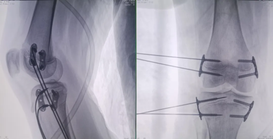 5f3036ab96a462269c15e6bb2b17eb3a.png 5f3036ab96a462269c15e6bb2b17eb3a.png