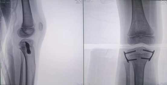 ab58db660e8e25efdbcbac9e99fbf9ca.png ab58db660e8e25efdbcbac9e99fbf9ca.png