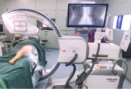 Correcting Limb Length Discrepancy | 3D C-arm Assisted Epiphysiodesis in Pediatric and Adolescent Patients